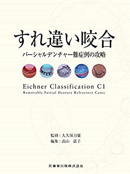 すれ違い咬合　パーシャルデンチャー難症例の攻略 (0)(未使用 未開封の中古品)