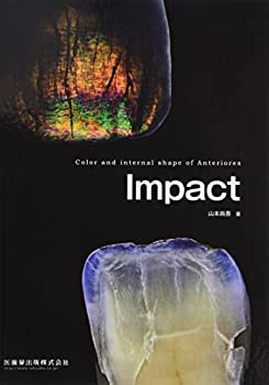 Impact Color and internal shape of Anteriores(中古品)