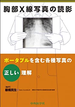 胸部X線写真の読影—ポータブルを含む各種写真の正しい理解(未使用 未開封の中古品)の通販は 20,865円