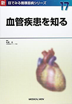 血管疾患を知る (新 目でみる循環器病シリーズ 17)(未使用 未開封の中古品)