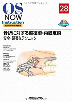 骨折に対する整復術・内固定術?安全・確実なテクニック (OS NOW Instructio(未使用 未開封の中古品)の通販は 16,490円