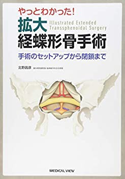 やっとわかった! 拡大経蝶形骨手術?手術のセットアップから閉鎖まで(未使用 未開封の中古品)の通販は
