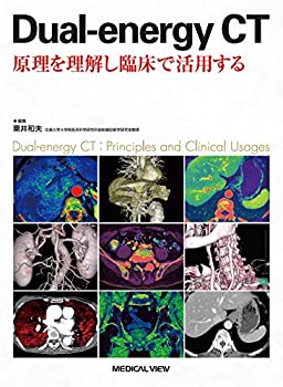 Dual-energy CT 原理を理解し臨床で活用する(中古品) 17,160円