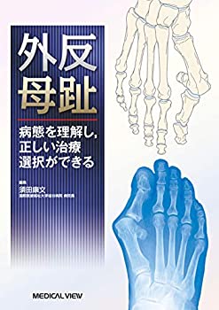 外反母趾?病態を理解し%ｶﾝﾏ%正しい治療選択ができる(中古品)の通販は