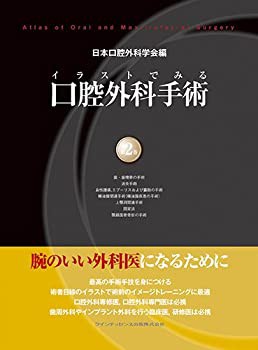 イラストでみる口腔外科手術　第2巻(中古品)