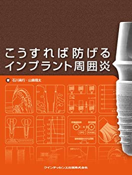 こうすれば防げるインプラント周囲炎(中古品)の通販は