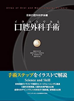 イラストでみる口腔外科手術 第3巻(未使用 未開封の中古品)