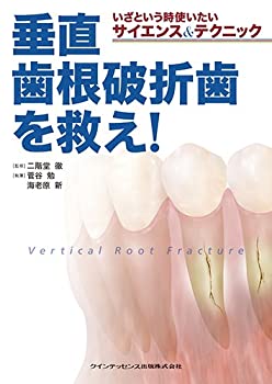 いざという時使いたいサイエンス&テクニック 垂直歯根破折歯を救え!(中古品)の通販は