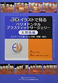 3Dイラストで見るペリオドンタルプラスティックサージェリー 天然歯編(未使用 未開封の中古品)