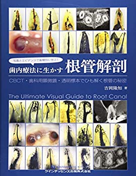 写真とエビデンスで歯種別に学ぶ! 歯内療法に生かす根管解剖(未使用 未開封の中古品)の通販は