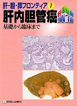 肝内胆管癌—基礎から臨床まで (肝・胆・膵フロンティア)(中古品)の通販は