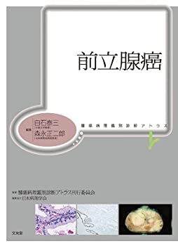 前立腺癌 (腫瘍病理鑑別診断アトラス)(中古品)の通販は