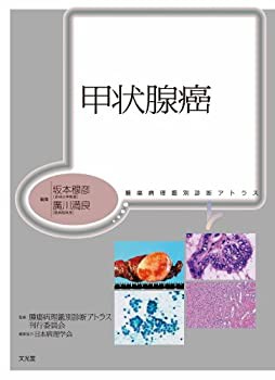 甲状腺癌 (腫瘍病理鑑別診断アトラス)(中古品)の通販は