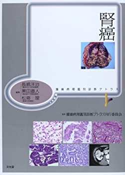 腎癌 (腫瘍病理鑑別診断アトラス)(中古品)の通販は
