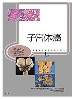 子宮体癌 (腫瘍病理鑑別診断アトラス)(未使用 未開封の中古品)