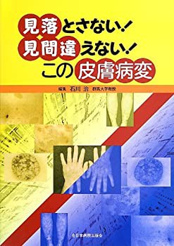 見落とさない! 見間違えない! この皮膚病変(未使用 未開封の中古品)の通販は