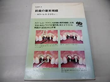 前歯の審美補綴—カラーレス・クラウン (quintessence books)(未使用 未開封の中古品)