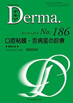 口腔粘膜・舌病変の診療 (MB Derma (デルマ))(中古品)の通販は