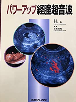 パワーアップ経腟超音波(中古品)の通販は