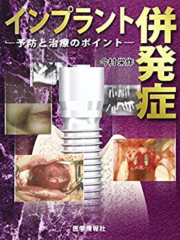 インプラント併発症—予防と治療のポイント(未使用 未開封の中古品) 23,100円