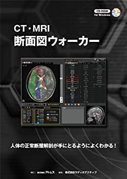 CT・MRI 断面図ウォーカー(中古品)の通販は