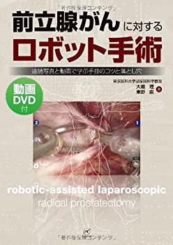 前立腺がんに対するロボット手術?連続写真と動画で学ぶ手技のコツと落とし (未使用 未開封の中古品)