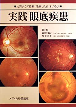 実践 眼底疾患—どのように診断・治療したらよいのか(未使用 未開封の中古品)