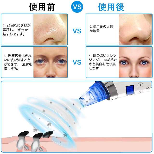 年最新改良版 毛穴吸引器 毛穴クリーナー ニキビ吸引 毛穴ケア 角栓 汚れ除去 シワ減少 黒ずみ吸出 毛穴クリーン 角栓 たるみ改善の通販はau Pay マーケット くらしきママ