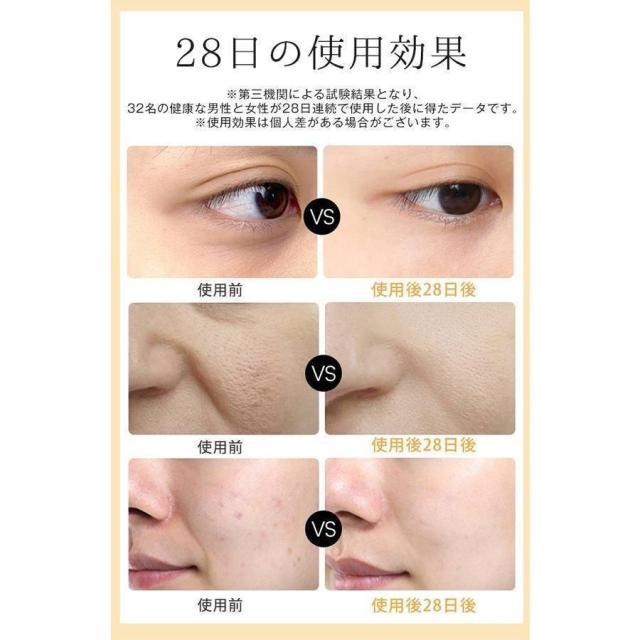 美顔器 リフトアップ効果 EMS 母の日 50代 線フェイスライン 目元使用可能 腫れ解消 20代 30代 40代 ギフトフォト プレゼント