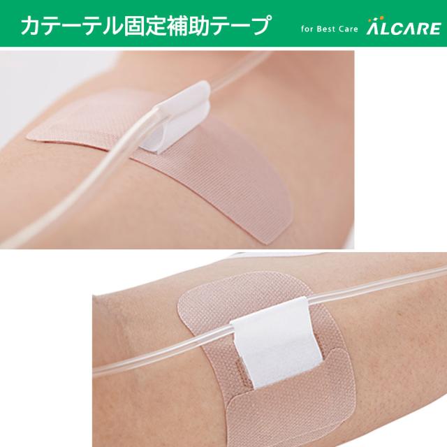 クイックフィックス (2号) 21372 1箱(15枚入り) アルケア カテーテル