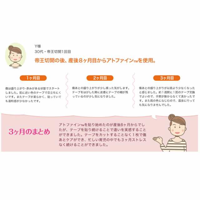 ニチバン アトファイン 4箱セット 帝王切開の傷 手術後 傷 傷あと ケア