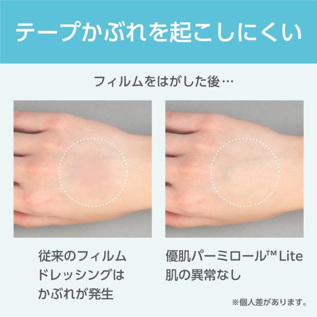 ニトリート 優肌パーミロールLite L34R15（15CMX12M）1巻 1箱