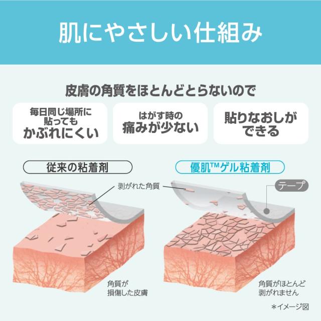 ニトリート 優肌パーミロールLite L34R05（5CMX12M）1巻 1箱