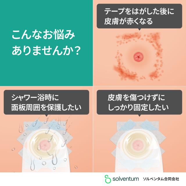 【国内正規品】3M マイクロポアS やさしくはがせる シリコーンテープ 2775-2 1箱(1巻入/幅50mm×5m) 肌に優しい 低刺激 サージカルテープ 粘着包帯 手で切れる_2