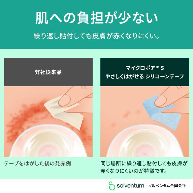 【国内正規品】3M マイクロポアS やさしくはがせる シリコーンテープ 2775-2 1箱(1巻入/幅50mm×5m) 肌に優しい 低刺激 サージカルテープ 粘着包帯 手で切れる_3