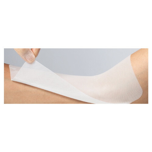 アルケア エスアイエイド・メッシュ（５号） 19272（50マイイリ）