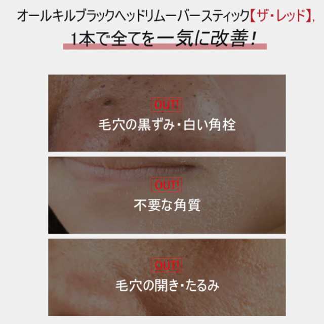 ポイント5倍UP中】☆当店限定☆韓国コスメ 毛穴ケア rire リール リル All Kill Blackhead Remover オールキル・ ブラックヘッドリムーバー ニキビ痕 洗顔水の通販はau PAY マーケット - LUDIAPLUS | au PAY マーケット－通販サイト