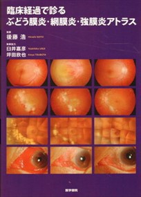 臨床経過で診るぶどう膜炎・網膜炎・強膜炎アトラス