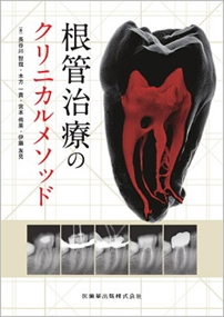 根管治療のクリニカルメソッド