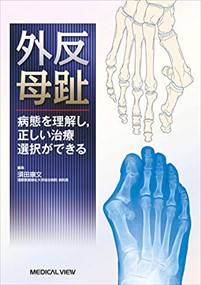 外反母趾 病態を理解し，正しい治療選択ができる