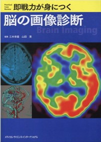 即戦力が身につく脳の画像診断 即戦力が身につく脳の画像診断