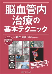 脳血管内治療の基本テクニック コマ送り解説で知識と技術が結びつく