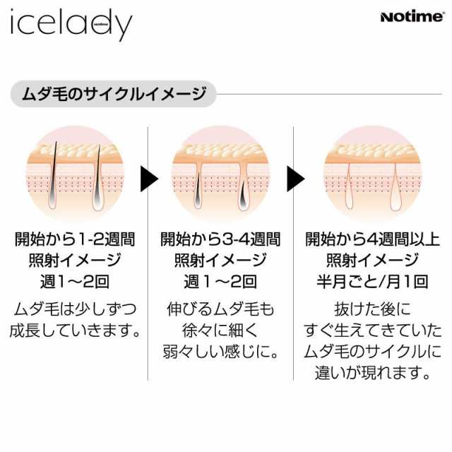 脱毛器 アイスレディ Icelady 正規取扱店 Ipl脱毛器 家庭用光美顔器 Notime Skb 1808 メーカー1年保証付の通販はau Pay マーケット Els