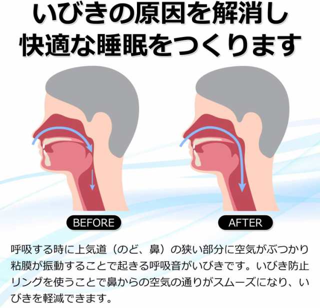 いびき防止 リング いびき いびき対策 睡眠グッズ 指輪 いびき+リング イビキ 防止 いびき防止グッズ いびき対策 イビキ防止グッズ 安眠の通販はau  PAY マーケット - エブリワン