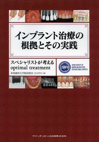 [書籍]/インプラント治療の根拠とその実践 スペシャリストが考えるoptimal treatment/米国歯科大学院同窓会/編/NEOBK-1612809
