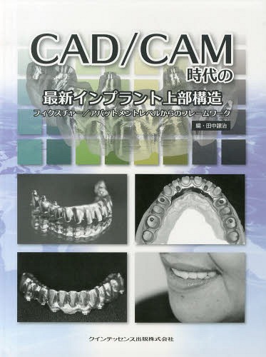 [書籍]/CAD/CAM時代の最新インプラント上部構造 フィクスチャー/アバットメントレベルからのフレームワーク/田中譲治/編/NEOBK-1612820