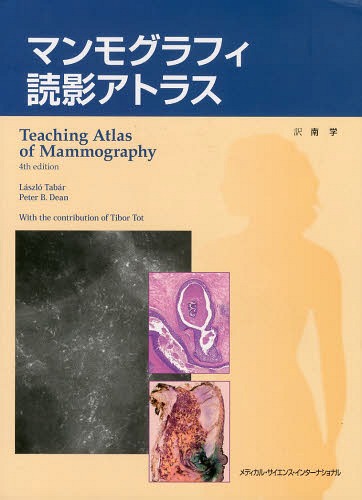 [書籍]/マンモグラフィ読影アトラス / 原タイトル:Teaching Atlas of Mammography 原著第4版の翻訳/ラズロ・ターバー/著 ピーター・B・ディーン/著 南学/訳/NEOBK-1637887