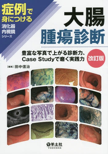 [書籍]/大腸腫瘍診断 豊富な写真で上がる診断力、Case Studyで磨く実践力 (症例で身につける消化器内視鏡シリーズ)/田中信治/編集/NEOBK-1731273