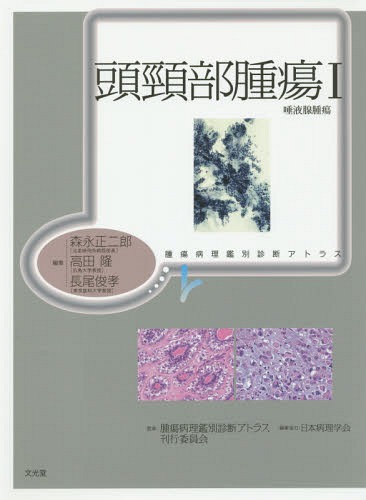 [書籍]/頭頸部腫瘍 1 (腫瘍病理鑑別診断アトラス)/森永正二郎/編集 高田隆/編集 長尾俊孝/編集 腫瘍病理鑑別診断アトラス刊行委員会/監修/NEOBK-1804163