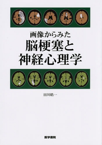[書籍]/画像からみた脳梗塞と神経心理学/田川皓一/著/NEOBK-1815992